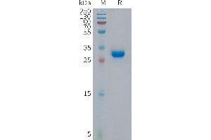 Human p16(11-40) Protein, hFc Tag on SDS-PAGE under reducing condition. (CDKN2A Protein (Fc Tag))