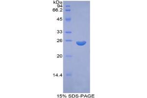 SDS-PAGE analysis of Rat Coagulation Factor IX Protein. (Coagulation Factor IX Protein (F9))