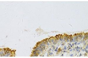 Immunohistochemistry of paraffin-embedded Rat lung using PA2G4 Polyclonal Antibody at dilution of 1:100 (40x lens). (PA2G4 anticorps)