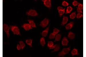 ABIN6267390 staining Hela by IF/ICC. (ATF2 anticorps  (pThr53, pThr71))