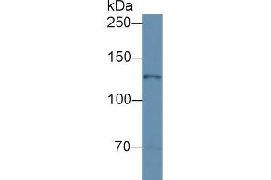 Detection of NOS2 in Mouse Cerebellum lysate using Polyclonal Antibody to Nitric Oxide Synthase 2, Inducible (NOS2) (NOS2 anticorps  (AA 526-659))