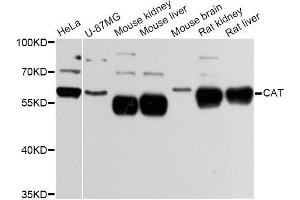 Western blot analysis of extracts of various cell lines, using CAT Antibody (ABIN5997374) at 1:3000 dilution. (Catalase anticorps)