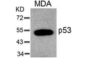 Image no. 1 for anti-Tumor Protein P53 (TP53) (AA 4-8) antibody (ABIN319299) (p53 anticorps  (AA 4-8))