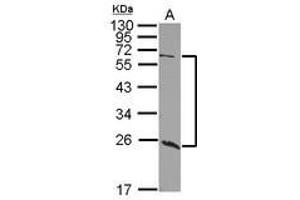 Image no. 1 for anti-Udp-N-Acetyl-alpha-D-Galactosamine:polypeptide N-Acetylgalactosaminyltransferase 9 (GalNAc-T9) (GALNT9) (AA 333-573) antibody (ABIN1498371) (GALNT9 anticorps  (AA 333-573))
