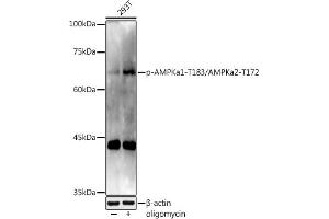 Western blot analysis of extracts of 293T cells, using Phospho-AMPKa1-T183/AMPKa2-T172 antibody (ABIN3020441, ABIN3020442, ABIN3020443 and ABIN1681942) at 1:1000 dilution. (AMPK alpha anticorps  (pThr172))