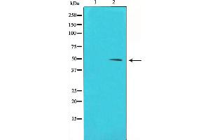 Western blot analysis of Cyclin E1 phosphorylation expression in Paclitaxel treated HeLa whole cell lysates,The lane on the left is treated with the antigen-specific peptide. (Cyclin E1 anticorps  (pThr395))