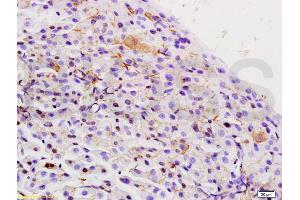 Formalin-fixed and paraffin embedded rat pancreas labeled with Rabbit Anti Integrin Alpha 3 + Beta 1 Polyclonal Antibody, Unconjugated (ABIN737031) at 1:200 followed by conjugation to the secondary antibody and DAB staining (Integrin Alpha3, Beta1 (AA 976-1025) anticorps)