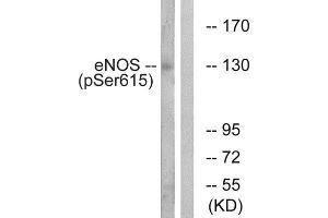 Western Blotting (WB) image for anti-Nitric Oxide Synthase 3 (Endothelial Cell) (NOS3) (pSer615) antibody (ABIN1847410) (ENOS anticorps  (pSer615))