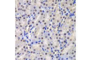 Immunohistochemistry of paraffin-embedded mouse kidney using GSTP1 antibody at dilution of 1:200 (400x lens). (GSTP1 anticorps)