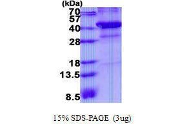 XRCC3 Protéine