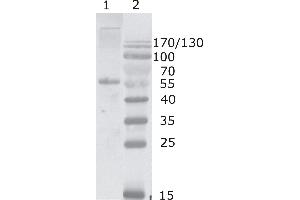 Western Blot testing of HIV-1 Gag p17/24 using HIV-1 p24 antibody, clone 2N32 (05-009). (HIV-1 p24 anticorps  (AA 80-90))