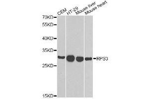 Western blot analysis of extracts of various cell lines, using RPS3 antibody. (RPS3 anticorps  (AA 1-243))