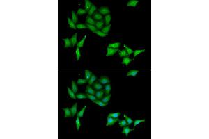 Immunofluorescence analysis of HeLa cells using CCNC antibody. (Cyclin C anticorps)