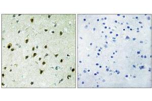 Immunohistochemistry analysis of paraffin-embedded human brain tissue, using MAD4 antibody. (MXD4 anticorps  (N-Term))
