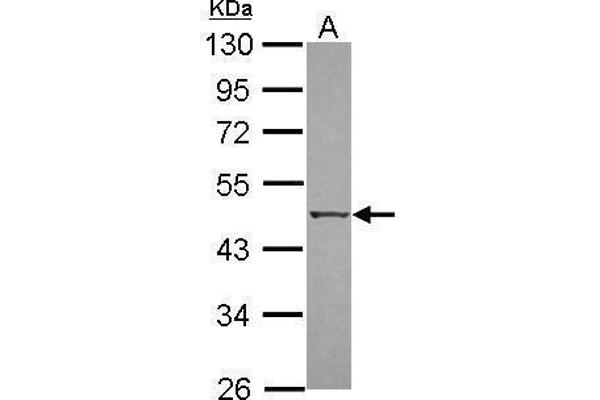 DAPK3 anticorps  (N-Term)