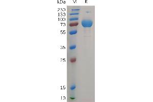 Human IF Protein, hFc Tag on SDS-PAGE under reducing condition. (IFNGR2 Protein (AA 28-247) (Fc Tag))
