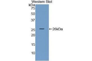 Western Blotting (WB) image for anti-Lipase, Hepatic (LIPC) (AA 25-247) antibody (ABIN1859670) (LIPC anticorps  (AA 25-247))