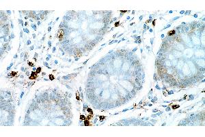 Human colon: immunohistochemical staining for Interleukin 6. (IL-6 anticorps  (N-Term))