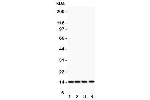 Western blot testing of PDGF-B antibody and Lane 1:  rat heart (PDGFB anticorps  (AA 82-190))
