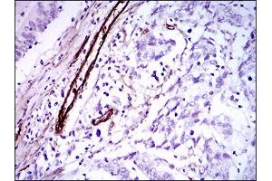 Immunohistochemistry (IHC) image for anti-Goosecoid Homeobox (GSC) (AA 191-257) antibody (ABIN1724843)