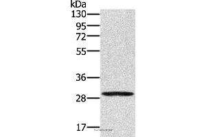 Western blot analysis of 293T cell, using EDA2R Polyclonal Antibody at dilution of 1:250 (Ectodysplasin A2 Receptor anticorps)