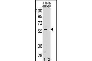 SMAD5 Antibody pre-incubated without(lane 1) and with(lane 2) blocking peptide in Hela cell line lysate. (SMAD5 anticorps  (AA 241-269))