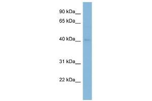 RAB3IL1 antibody used at 1 ug/ml to detect target protein. (RAB3IL1 anticorps)