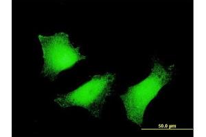 Immunofluorescence (IF) image for anti-Transglutaminase 2 (C Polypeptide, Protein-Glutamine-gamma-Glutamyltransferase) (TGM2) (AA 1-120) antibody (ABIN520891)