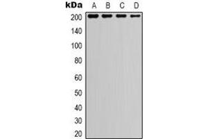 Western blot analysis of TSC2 expression in A549 (A), HEK293T (B), NIH3T3 (C), mouse kidney (D) whole cell lysates. (Tuberin anticorps)
