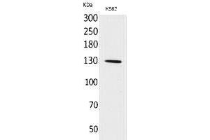 Western Blot analysis of K562 cells using Apaf-1 Polyclonal Antibody. (APAF1 anticorps  (Internal Region))