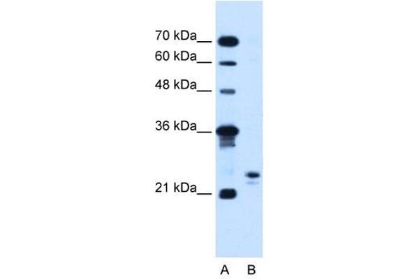 MOSPD3 anticorps  (C-Term)