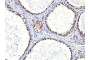 Image no. 1 for anti-Integrin Alpha2b (CD41) antibody (ABIN6156530) (Integrin Alpha2b anticorps)