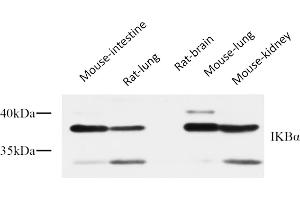 Western Blot analysis of Mouse intesting (1), rat lung (2), rat brain (3), mouse lung (4), mouse kidney (5), diluted at 1:1000. (NFKBIA anticorps  (AA 10-90))