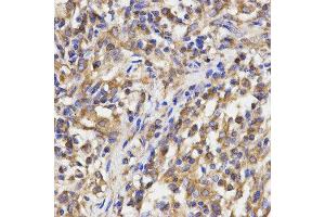 Immunohistochemistry (IHC) image for anti-Ribosomal Protein L5 (RPL5) antibody (ABIN1874650) (RPL5 anticorps)