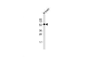 Western Blot at 1:2000 dilution + mouse brain lysates Lysates/proteins at 20 ug per lane. (PRMT3 anticorps  (N-Term))