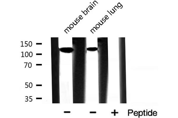 INPP5D anticorps  (C-Term)