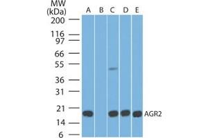 Image no. 1 for anti-Anterior Gradient Homolog 2 (Xenopus Laevis) (AGR2) (AA 50-100) antibody (ABIN1491565) (AGR2 anticorps  (AA 50-100))
