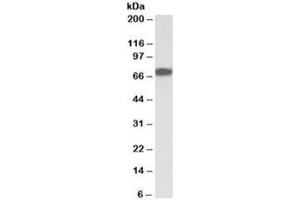 Western blot testing of albumin-depleted plasma lysate with Bradykinin antibody at 0. (KNG1 anticorps)