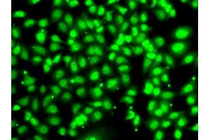 Immunofluorescence analysis of U2OS cells using COPS2 antibody. (COPS2 anticorps)