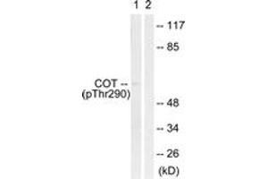 Western blot analysis of extracts from 293 cells treated with UV 15', using COT (Phospho-Thr290) Antibody. (CROT anticorps  (pThr290))