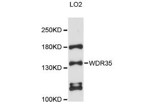 Western blot analysis of extracts of LO2 cells, using WDR35 antibody (ABIN6293806) at 1:3000 dilution. (WDR35 anticorps)