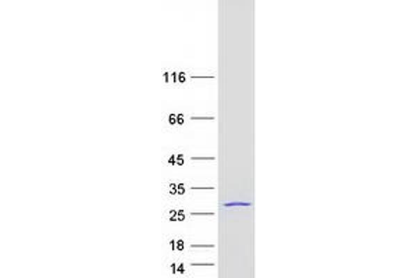 EIF3K Protein (Myc-DYKDDDDK Tag)