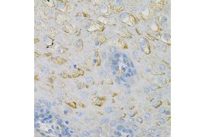 Immunohistochemistry of paraffin-embedded human esophagus using COX4I1 Antibody (ABIN2561975) at dilution of 1:100 (40x lens). (COX IV anticorps)