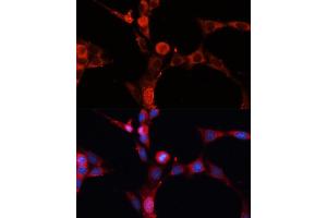 Immunofluorescence analysis of NIH-3T3 cells using SMPD1 / ASM Polyclonal Antibody (ABIN7270530) at dilution of 1:100 (40x lens). (SMPD1 anticorps)