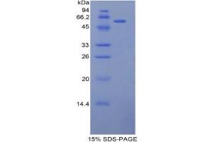 SDS-PAGE analysis of Mouse L1CAM Protein. (L1CAM Protéine)