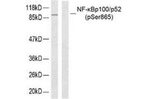 Western blot analysis of extracts from ovary cancer, using NF-kappaB p100/p52 (Phospho-Ser865) Antibody. (NFKB2 anticorps  (pSer866))