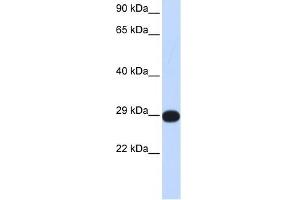 PPP4C antibody used at 1 ug/ml to detect target protein. (PPP4C anticorps)