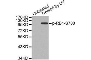 Western Blotting (WB) image for anti-Retinoblastoma 1 (RB1) (pSer780) antibody (ABIN1870571) (Retinoblastoma 1 anticorps  (pSer780))