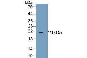 Detection of Recombinant CDKN1A, Mouse using Polyclonal Antibody to Cyclin Dependent Kinase Inhibitor 1A (CDKN1A) (p21 anticorps  (AA 2-159))
