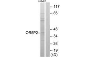 Western blot analysis of extracts from HuvEc cells, using OR5P2 Antibody. (OR5P2 anticorps  (AA 193-242))